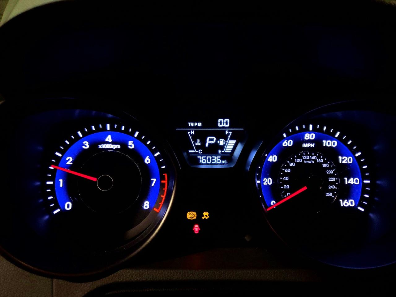 2015 HYUNDAI ELANTRA SE photo 25