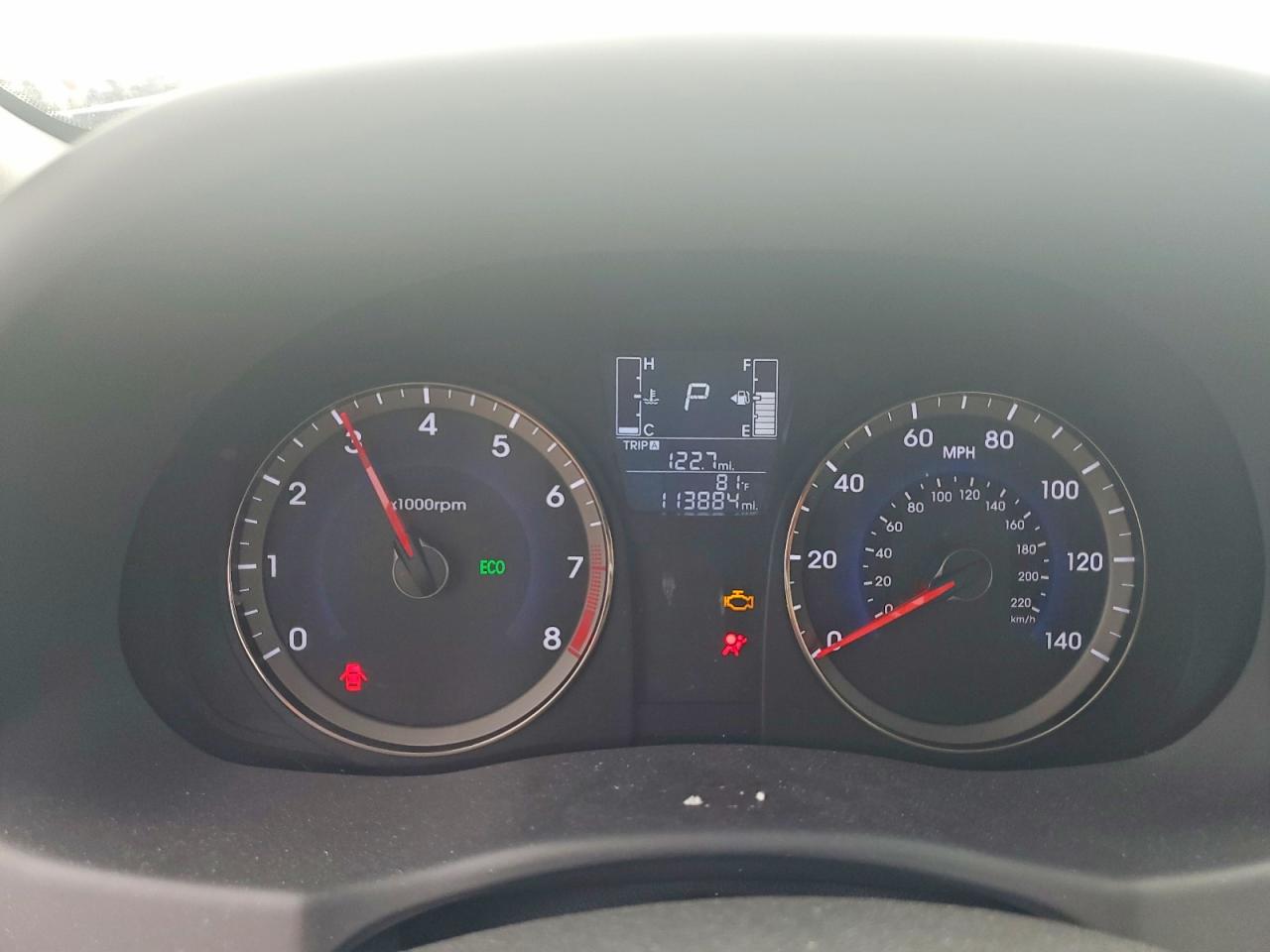 2017 HYUNDAI ACCENT SE photo 25