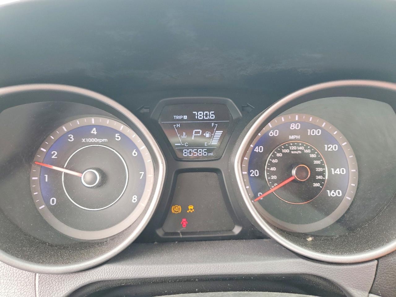 2015 HYUNDAI ELANTRA SE photo 17