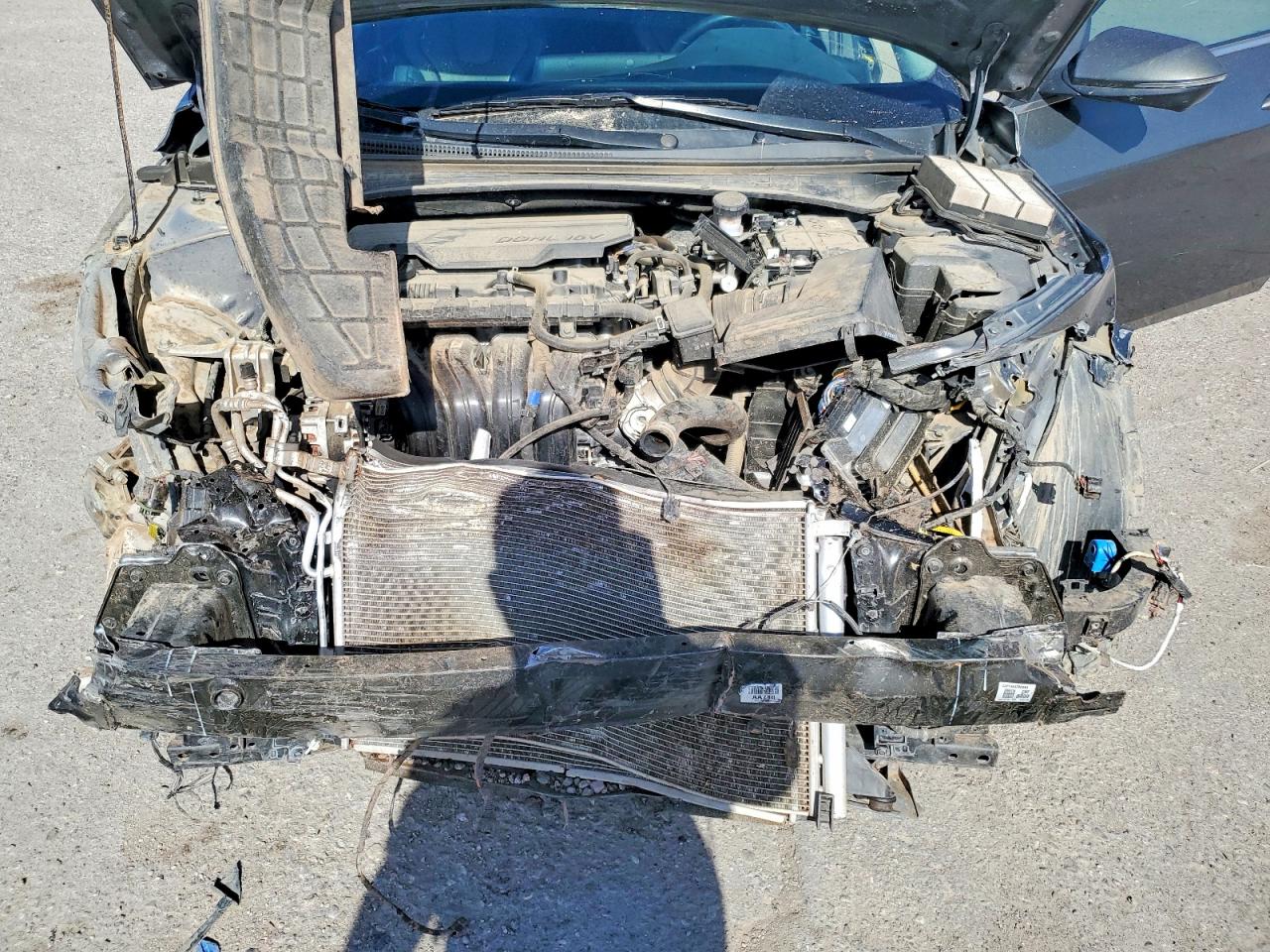 2024 HYUNDAI ELANTRA LIMITED photo 11