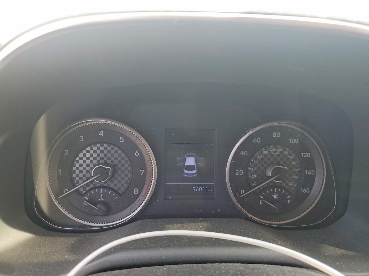 2020 HYUNDAI ELANTRA LIMITED photo 9