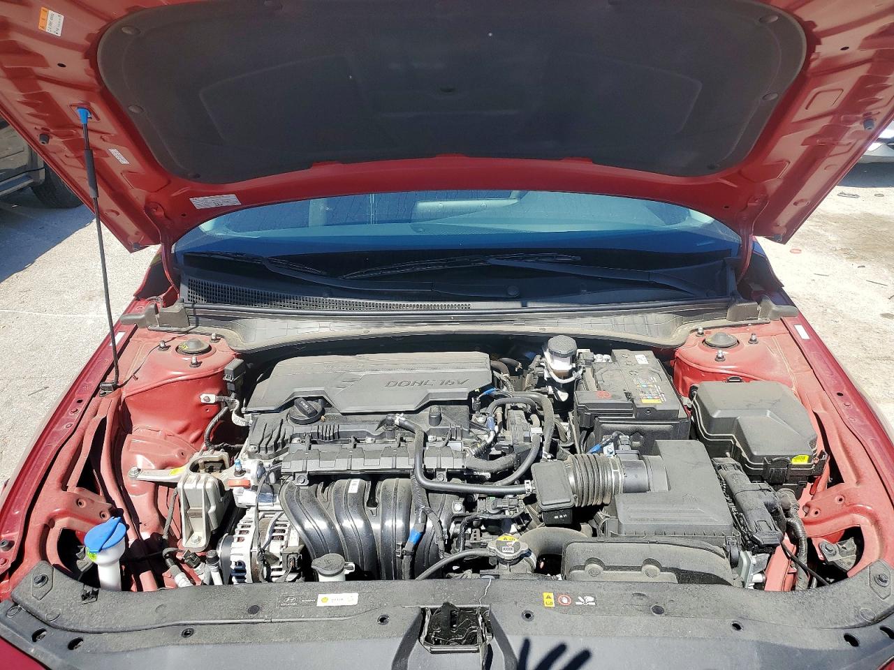 2024 HYUNDAI ELANTRA SEL photo 11