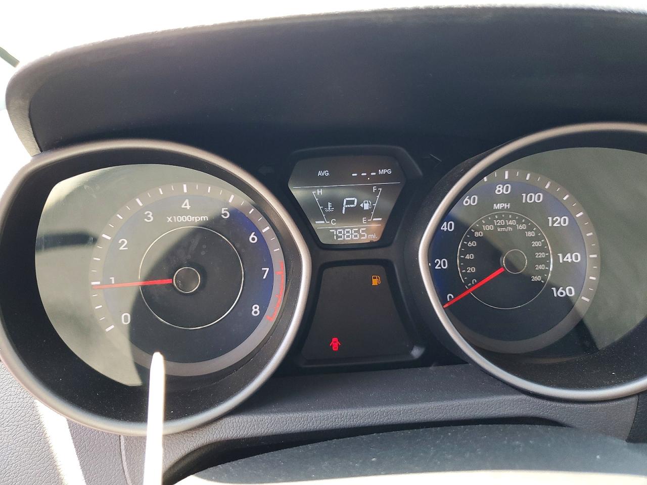 2014 HYUNDAI ELANTRA SE photo 17