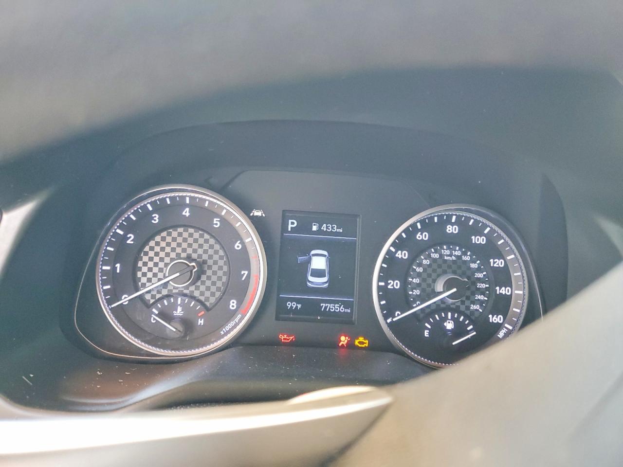 2020 HYUNDAI ELANTRA SEL photo 17