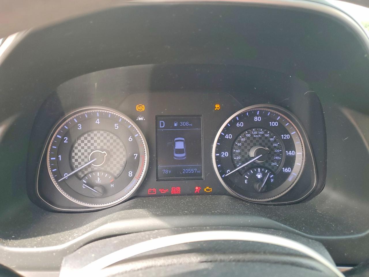 2020 HYUNDAI ELANTRA SE photo 17