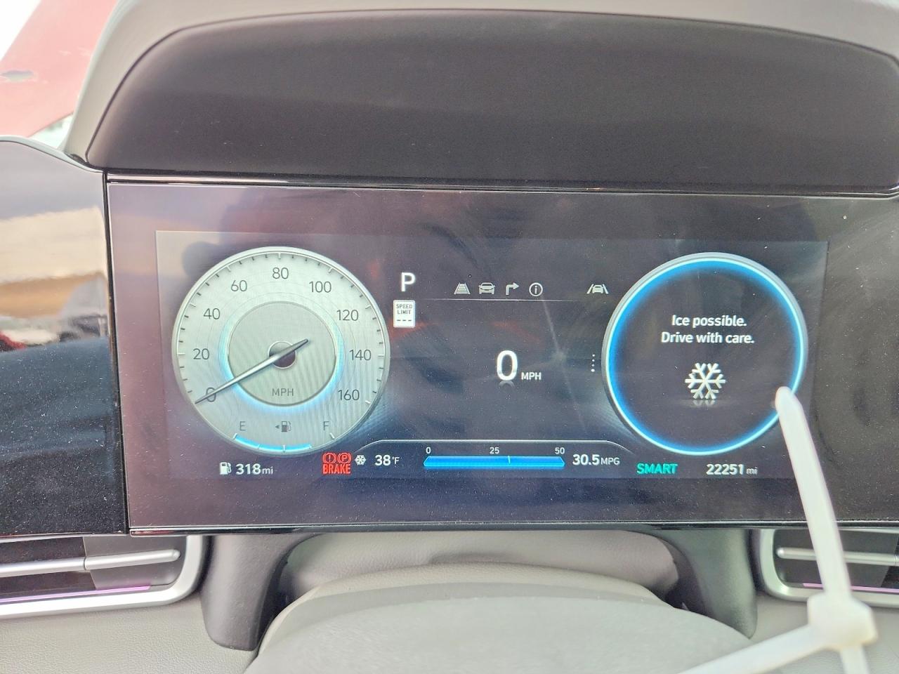 2024 HYUNDAI ELANTRA SEL photo 17