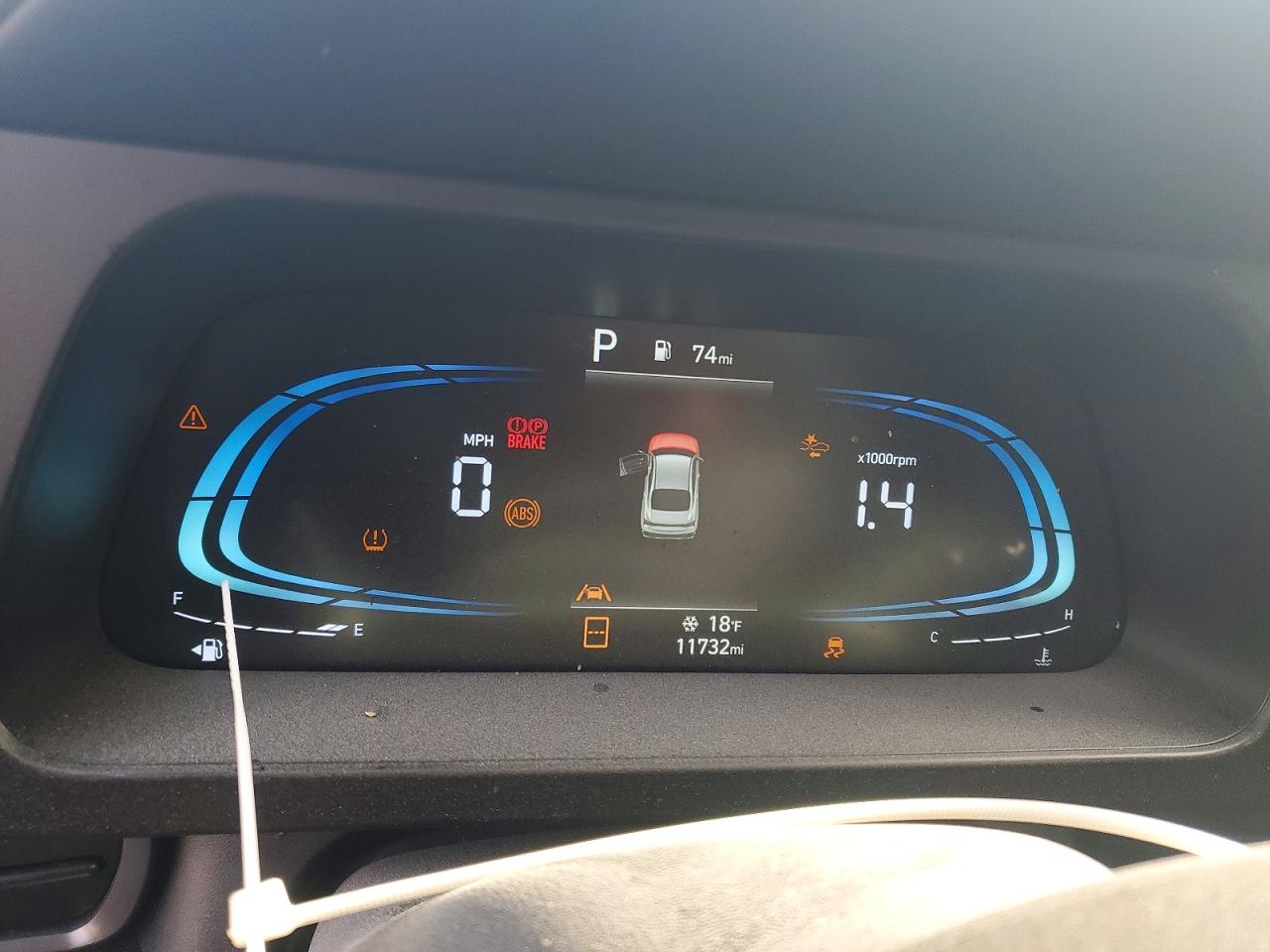 2025 HYUNDAI ELANTRA SEL SPORT photo 17