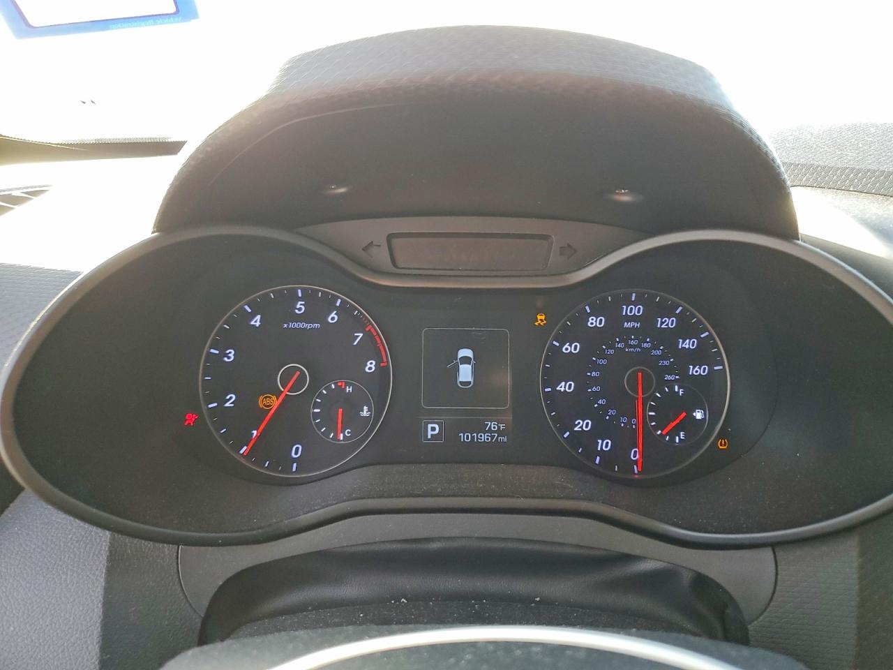 2016 HYUNDAI VELOSTER TURBO photo 17
