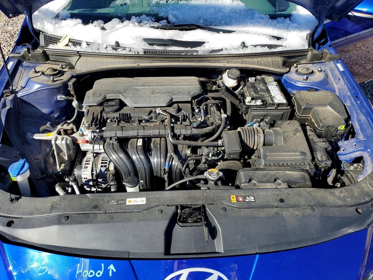 2024 HYUNDAI ELANTRA SEL photo 11