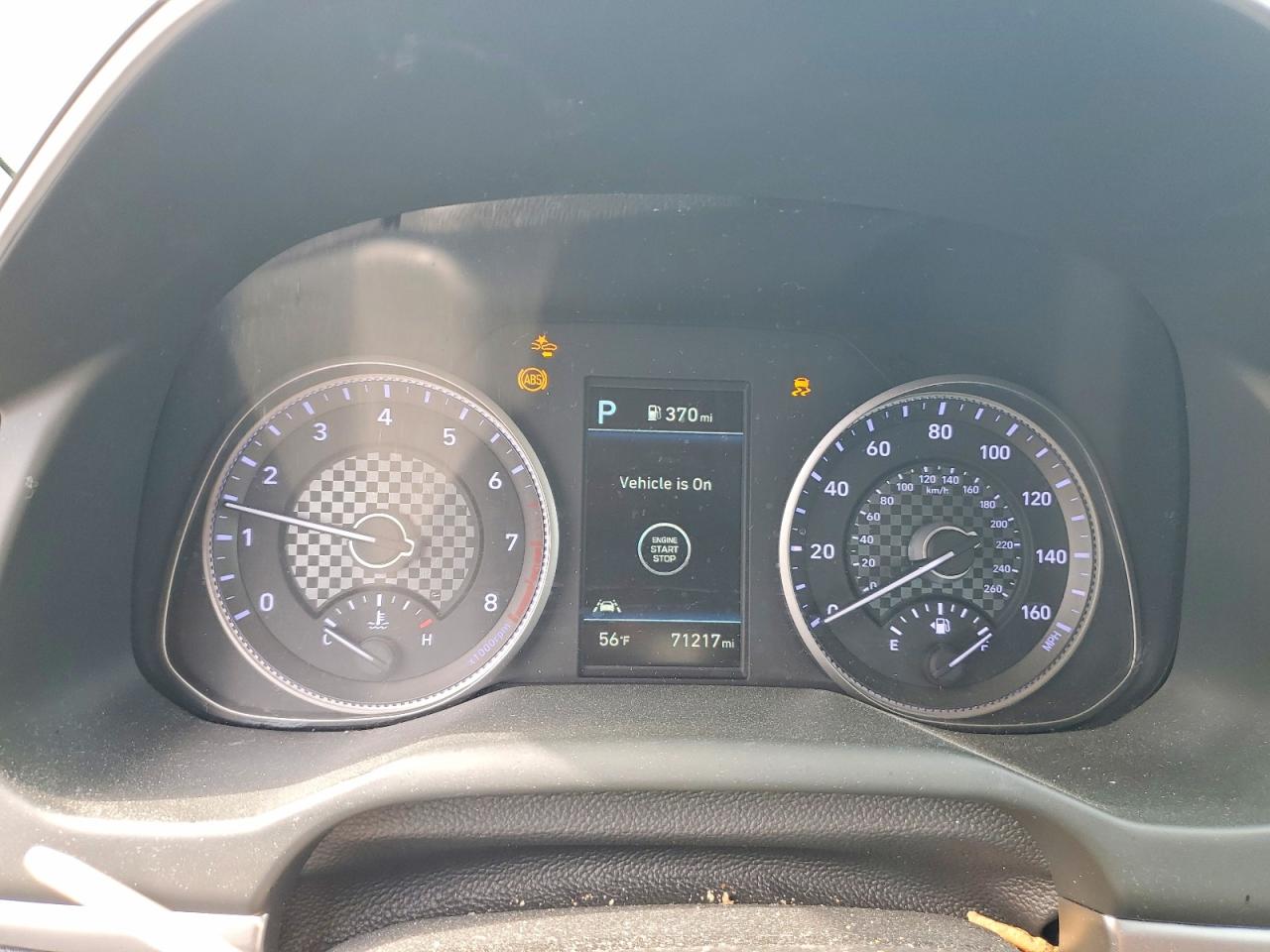 2020 HYUNDAI ELANTRA LIMITED photo 17