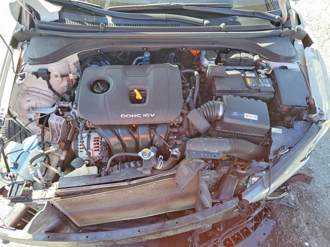 2017 HYUNDAI ELANTRA SE photo 31
