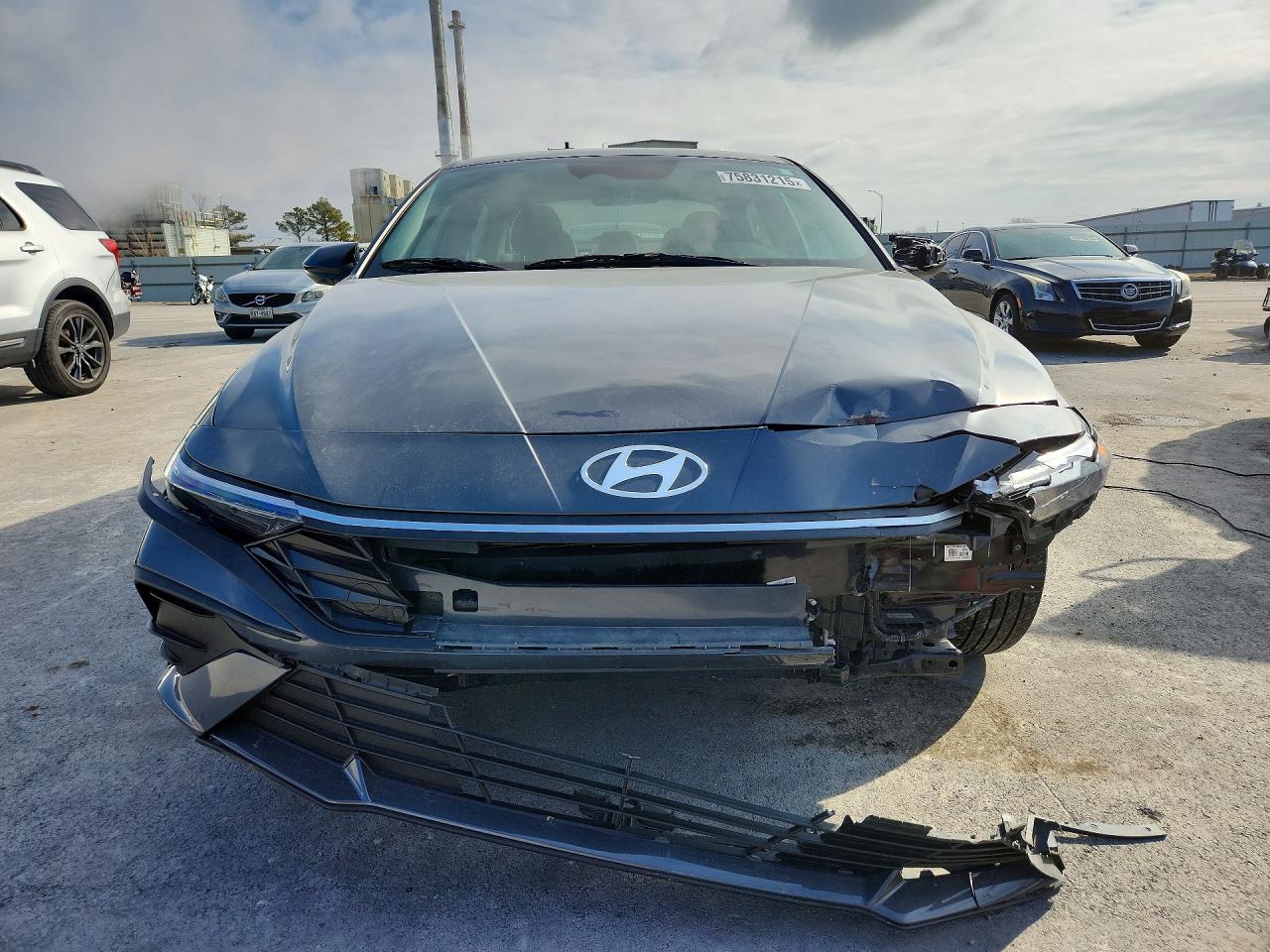 2025 HYUNDAI ELANTRA SEL SPORT photo 9