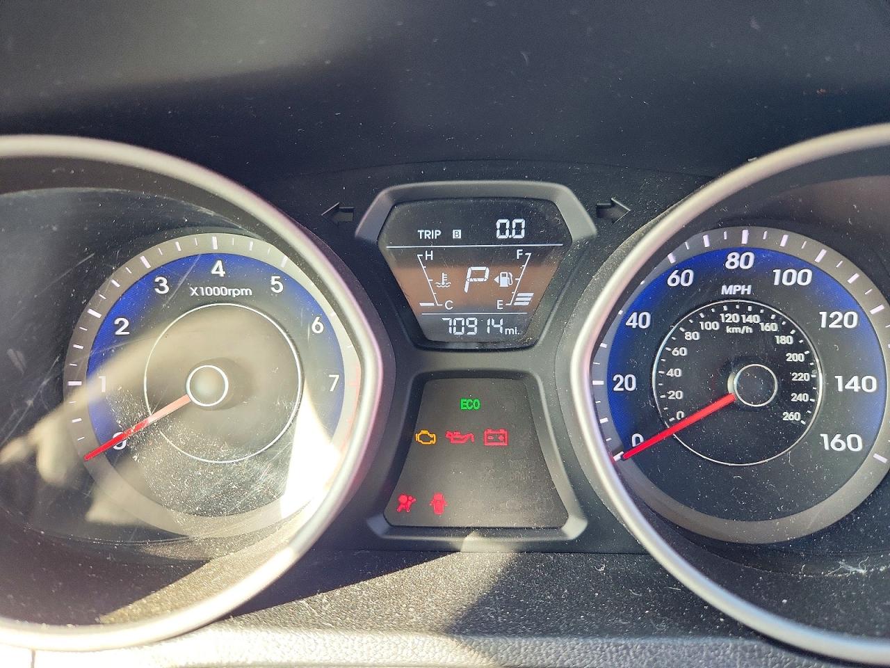 2015 HYUNDAI ELANTRA SE photo 9