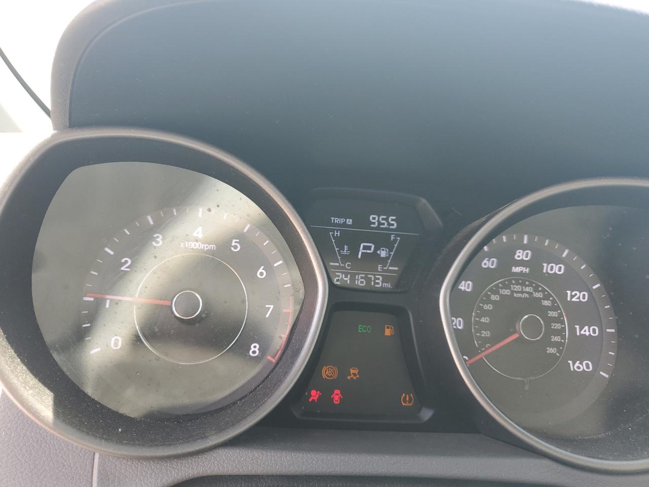 2016 HYUNDAI ELANTRA SE photo 17