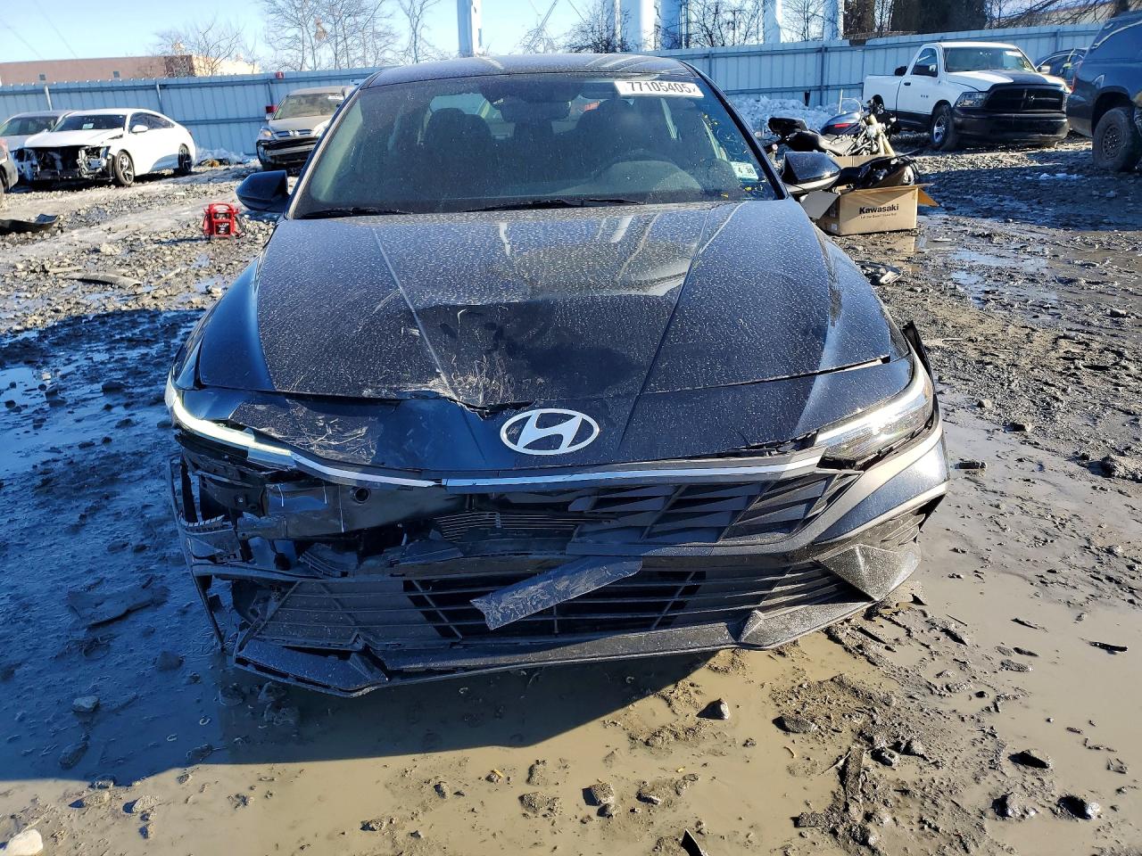 2025 HYUNDAI ELANTRA SEL SPORT photo 5