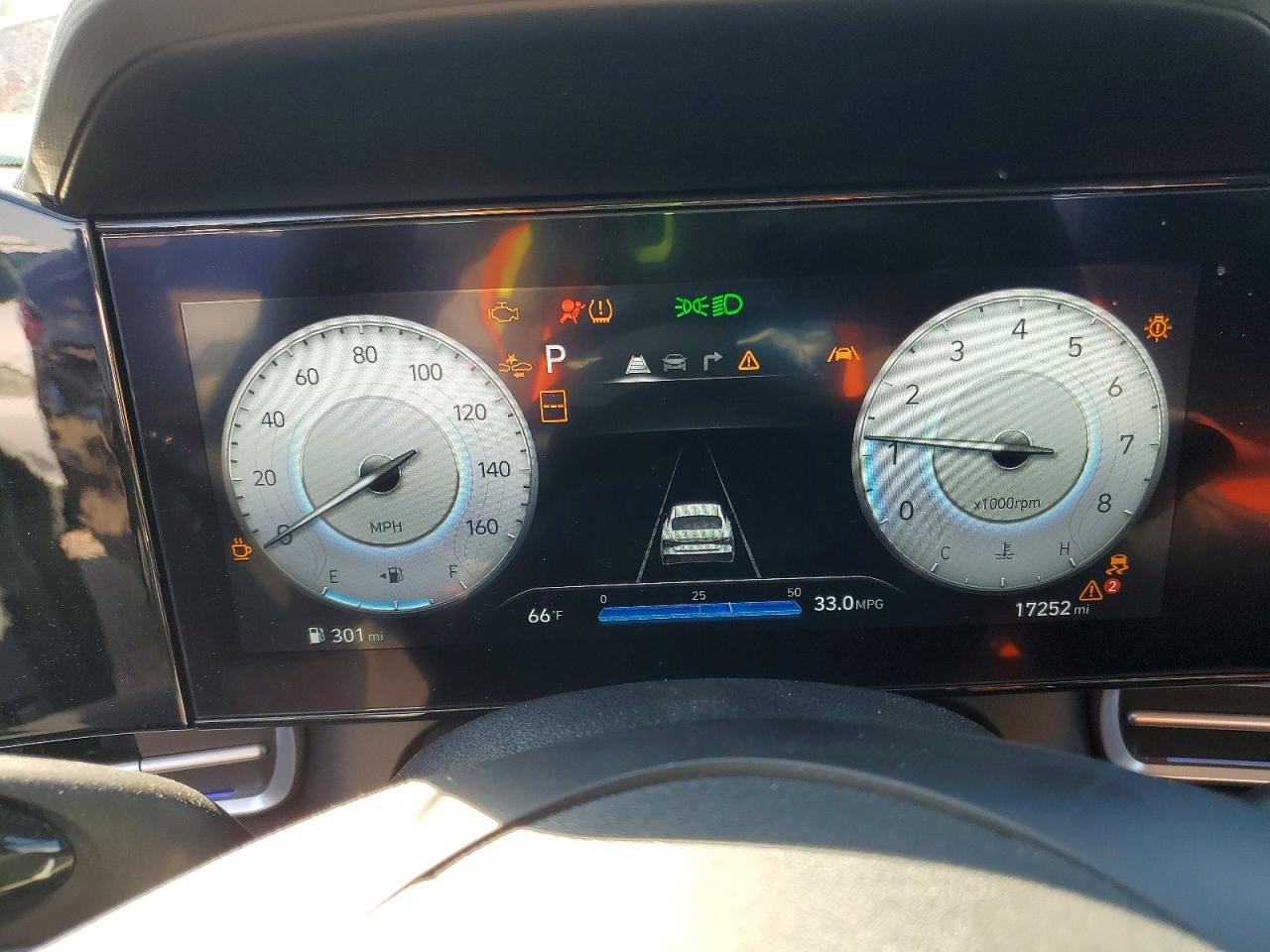 2024 HYUNDAI ELANTRA SEL photo 17