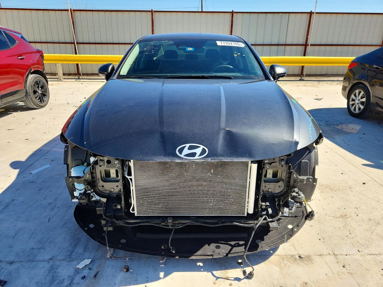 2024 HYUNDAI SONATA SEL photo 5