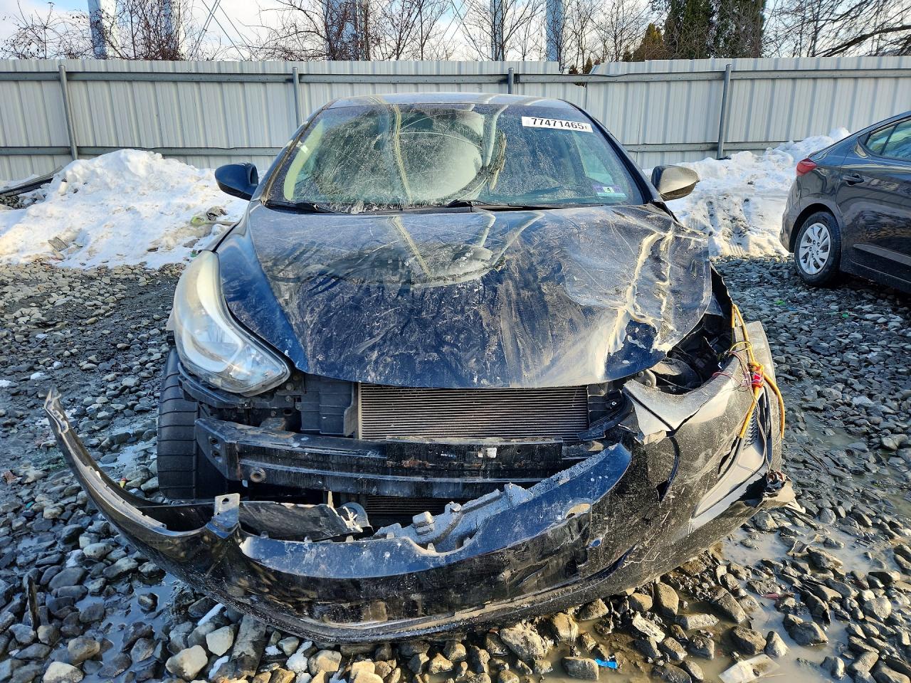 2015 HYUNDAI ELANTRA SE photo 9