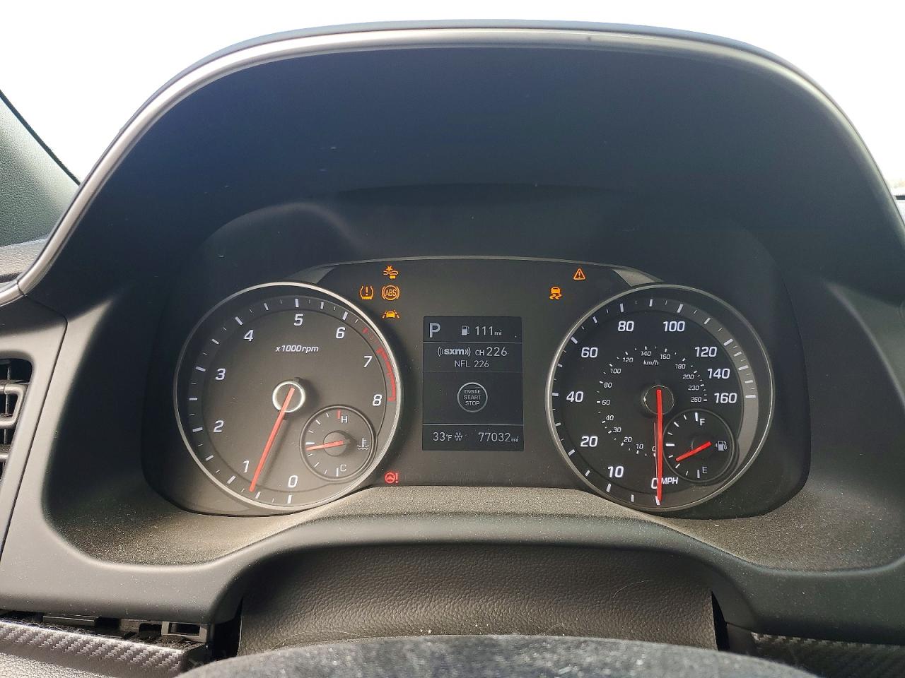 2020 HYUNDAI ELANTRA SPORT photo 17