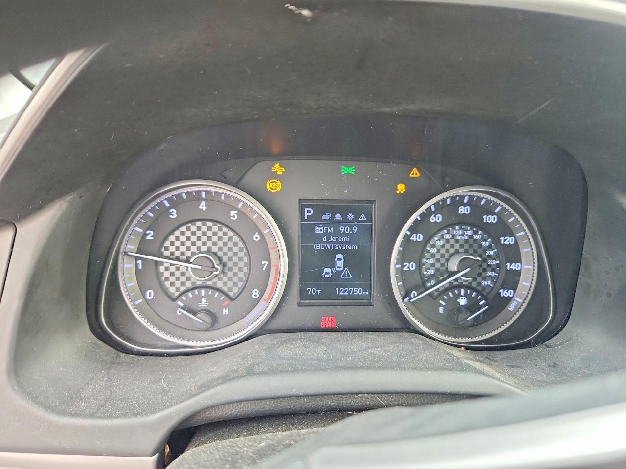 2020 HYUNDAI ELANTRA SEL photo 17