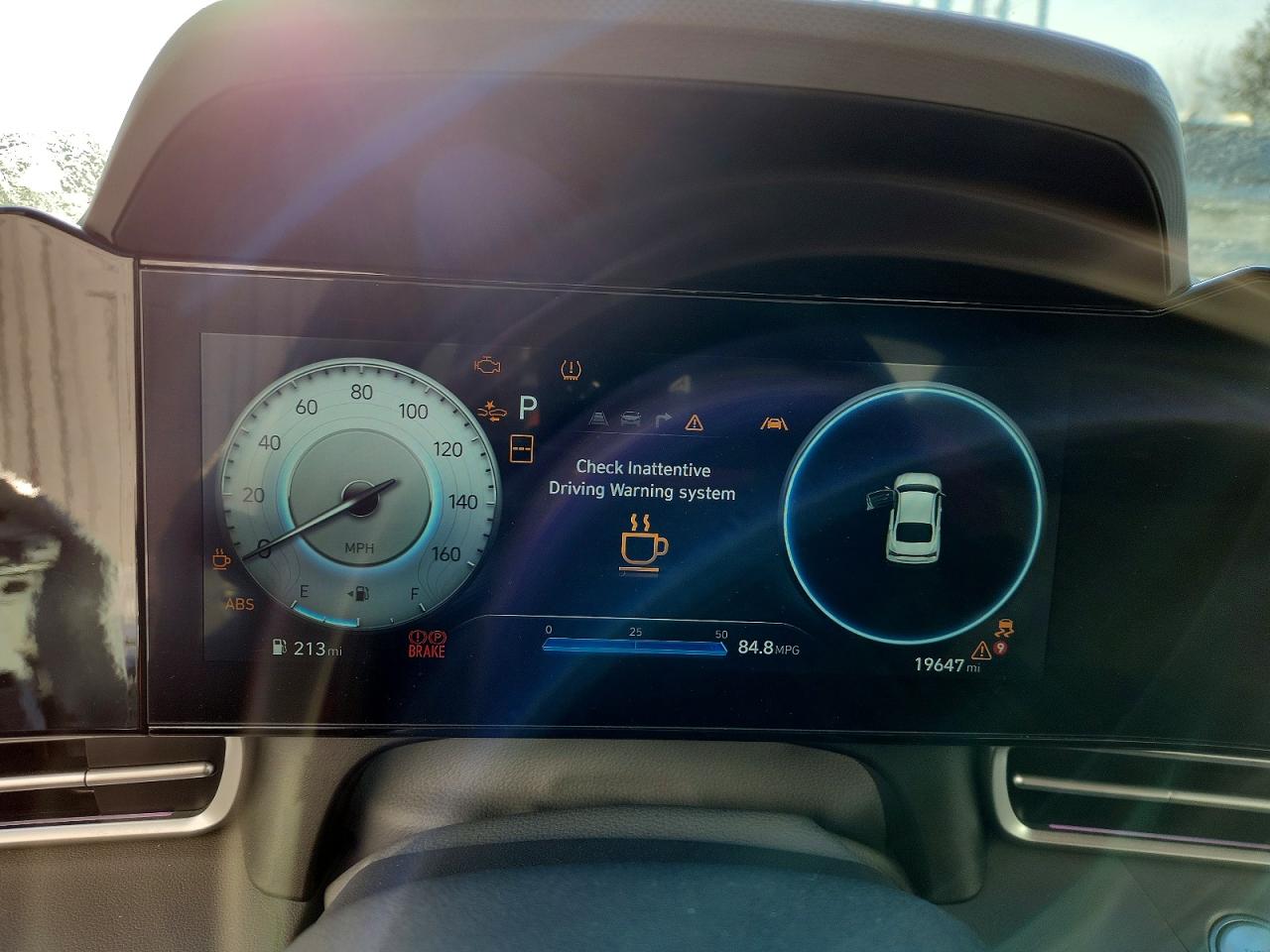 2024 HYUNDAI ELANTRA SEL photo 17