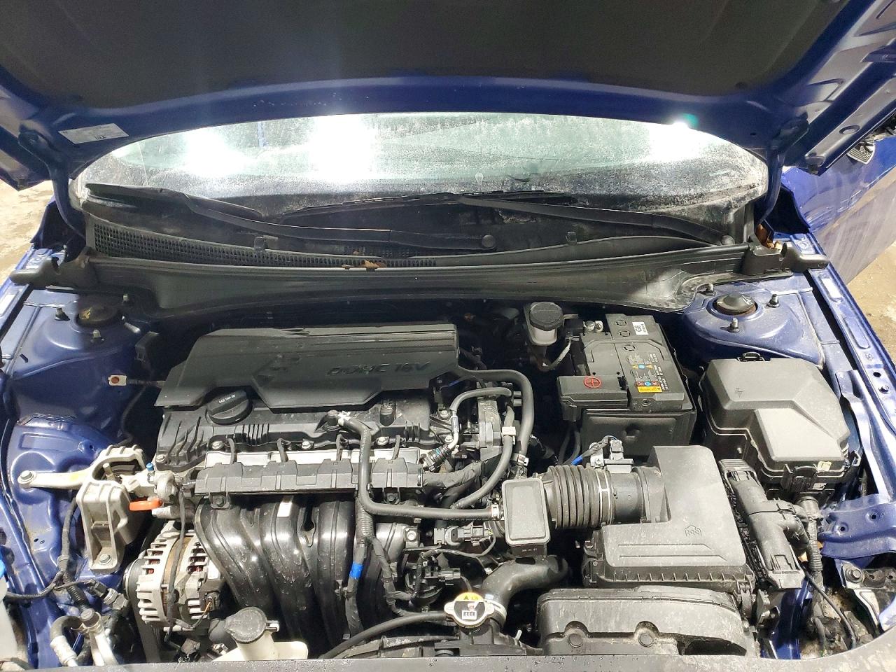 2024 HYUNDAI ELANTRA SEL photo 11