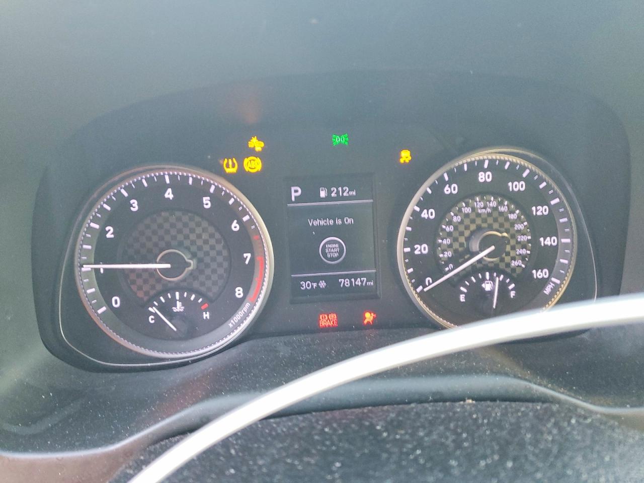 2020 HYUNDAI ELANTRA VALUE EDITION photo 17