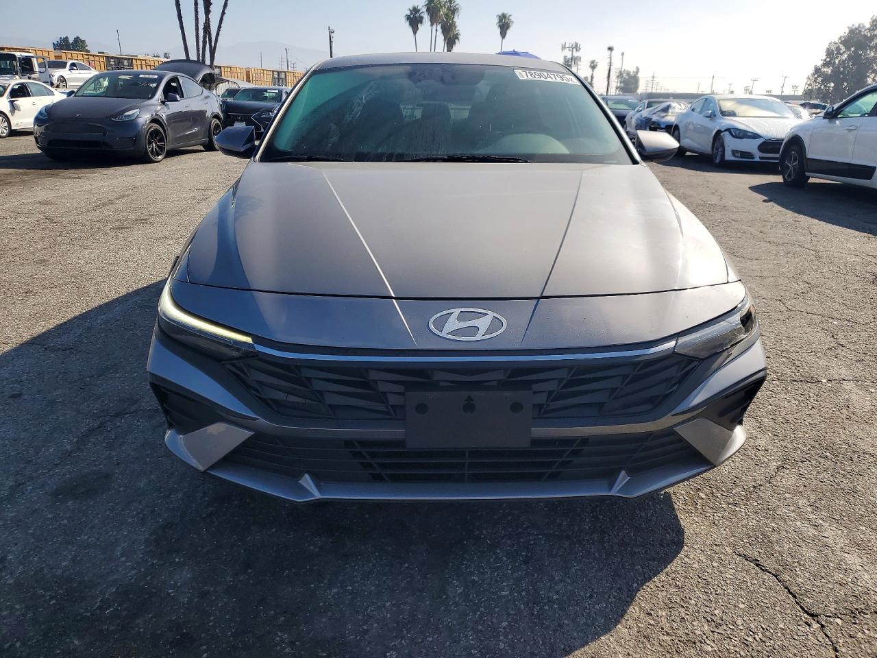 2025 HYUNDAI ELANTRA SE photo 5