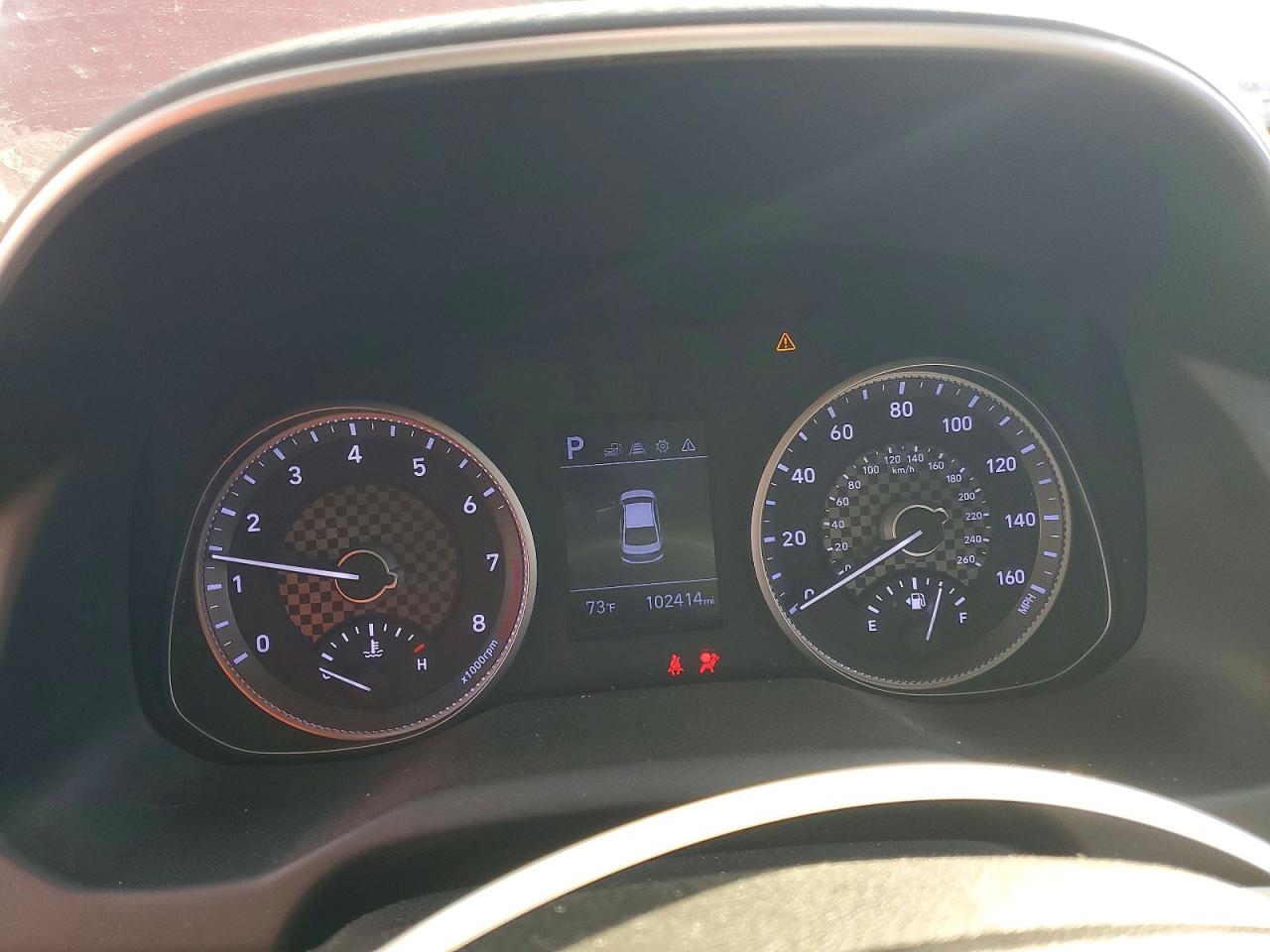 2020 HYUNDAI ELANTRA photo 9