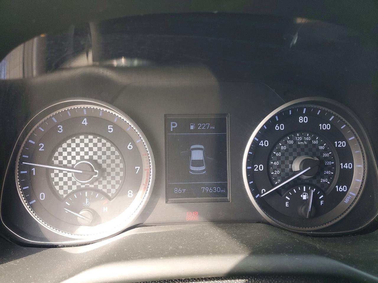 2020 HYUNDAI ELANTRA SEL photo 17