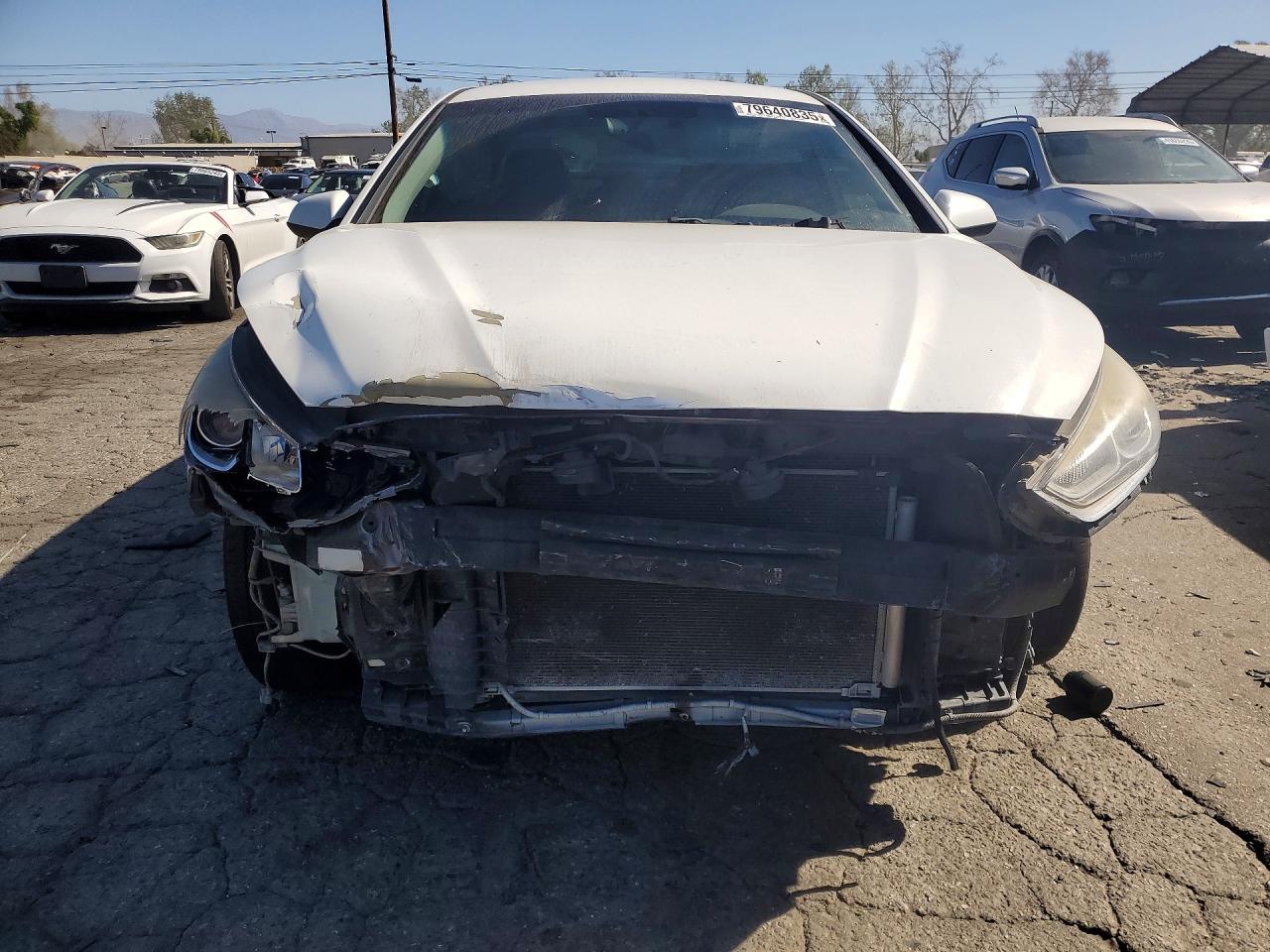 2018 HYUNDAI SONATA SE photo 9