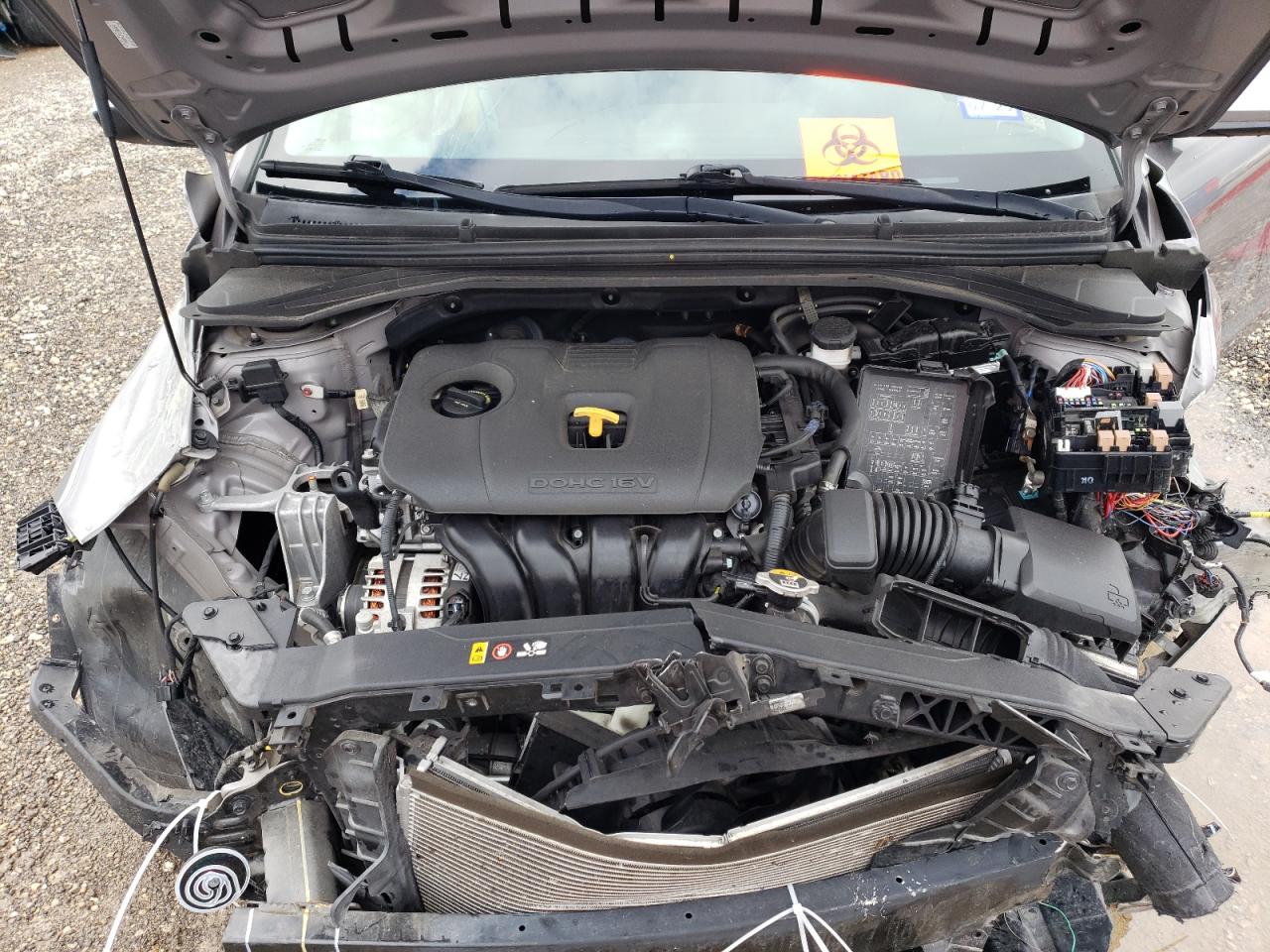 2020 HYUNDAI ELANTRA photo 11