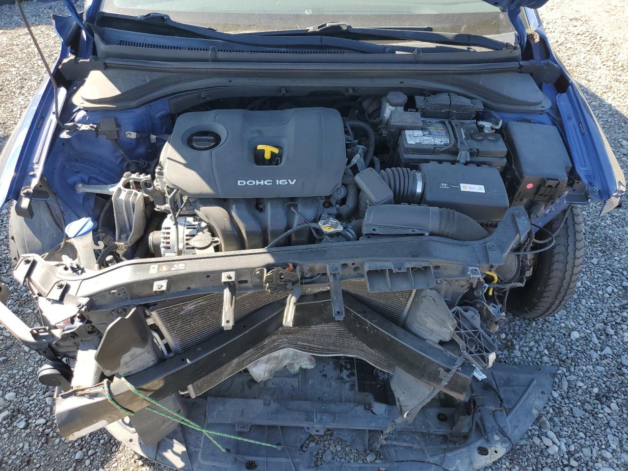 2017 HYUNDAI ELANTRA SE photo 21