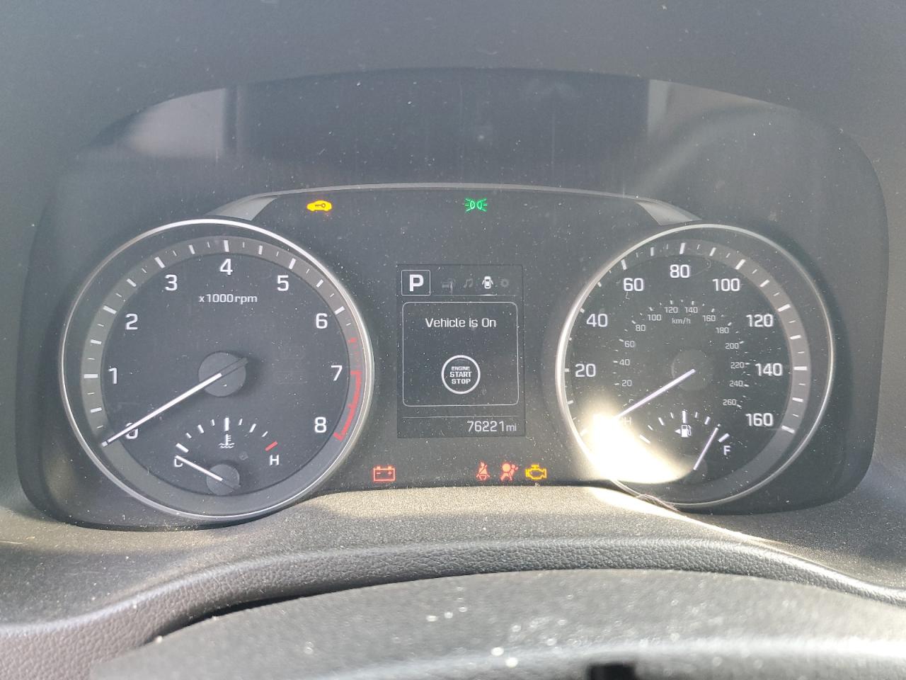2017 HYUNDAI ELANTRA SE photo 17