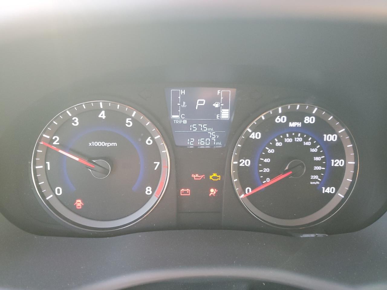 2017 HYUNDAI ACCENT VALUE EDITION photo 9