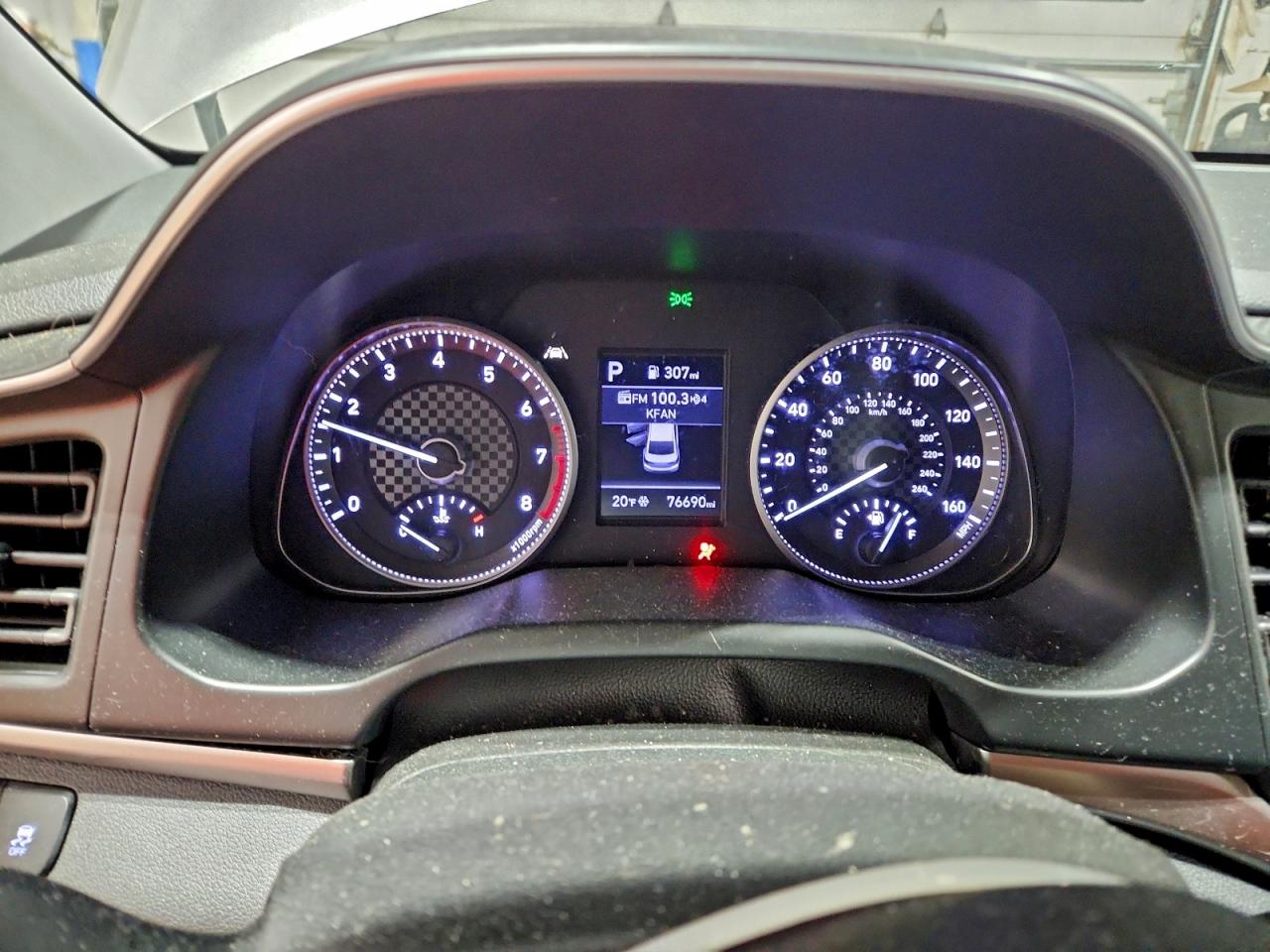 2020 HYUNDAI ELANTRA SEL photo 17