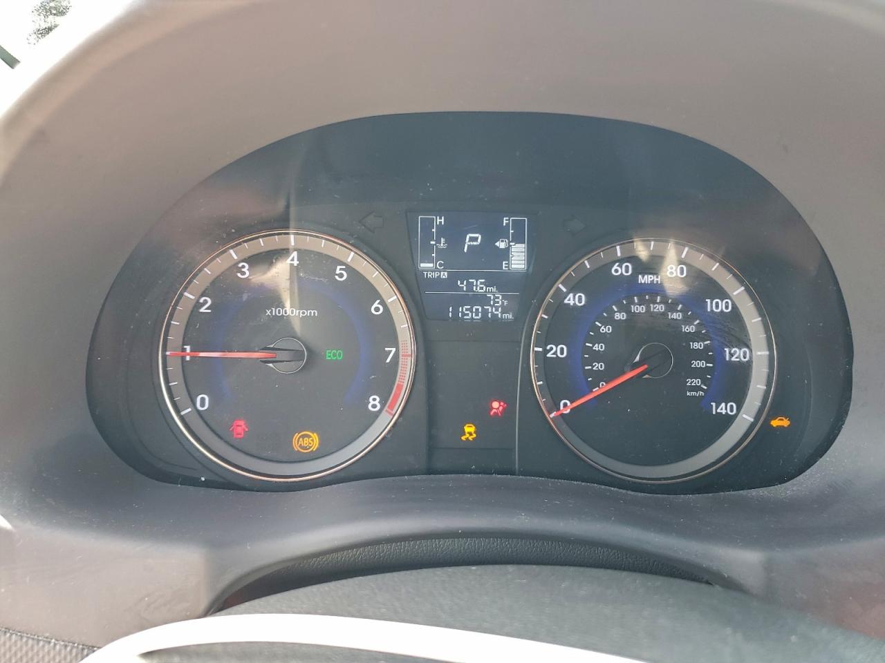 2017 HYUNDAI ACCENT SE photo 9