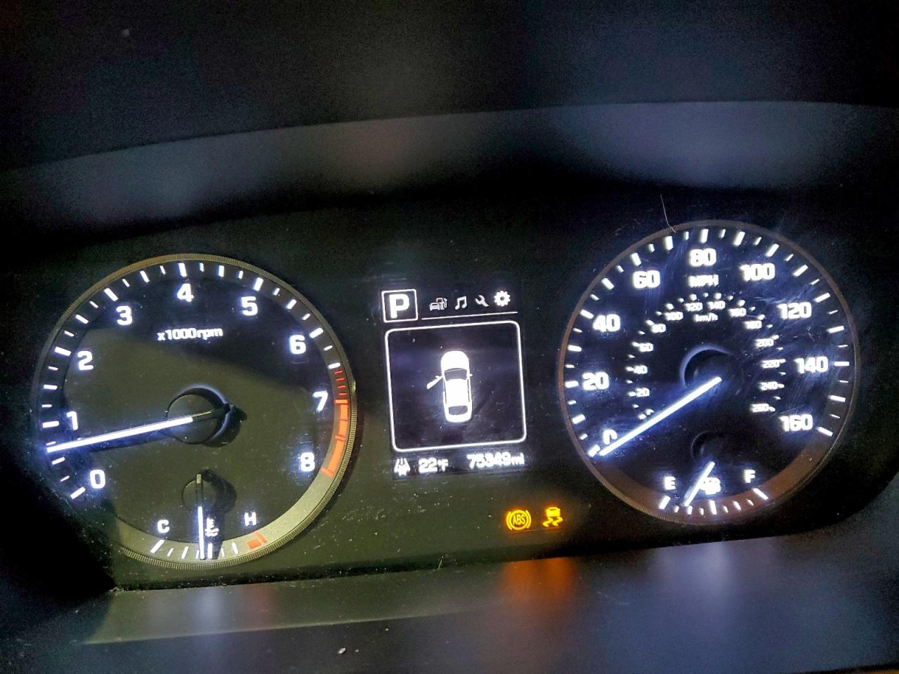 2015 HYUNDAI SONATA SE photo 17