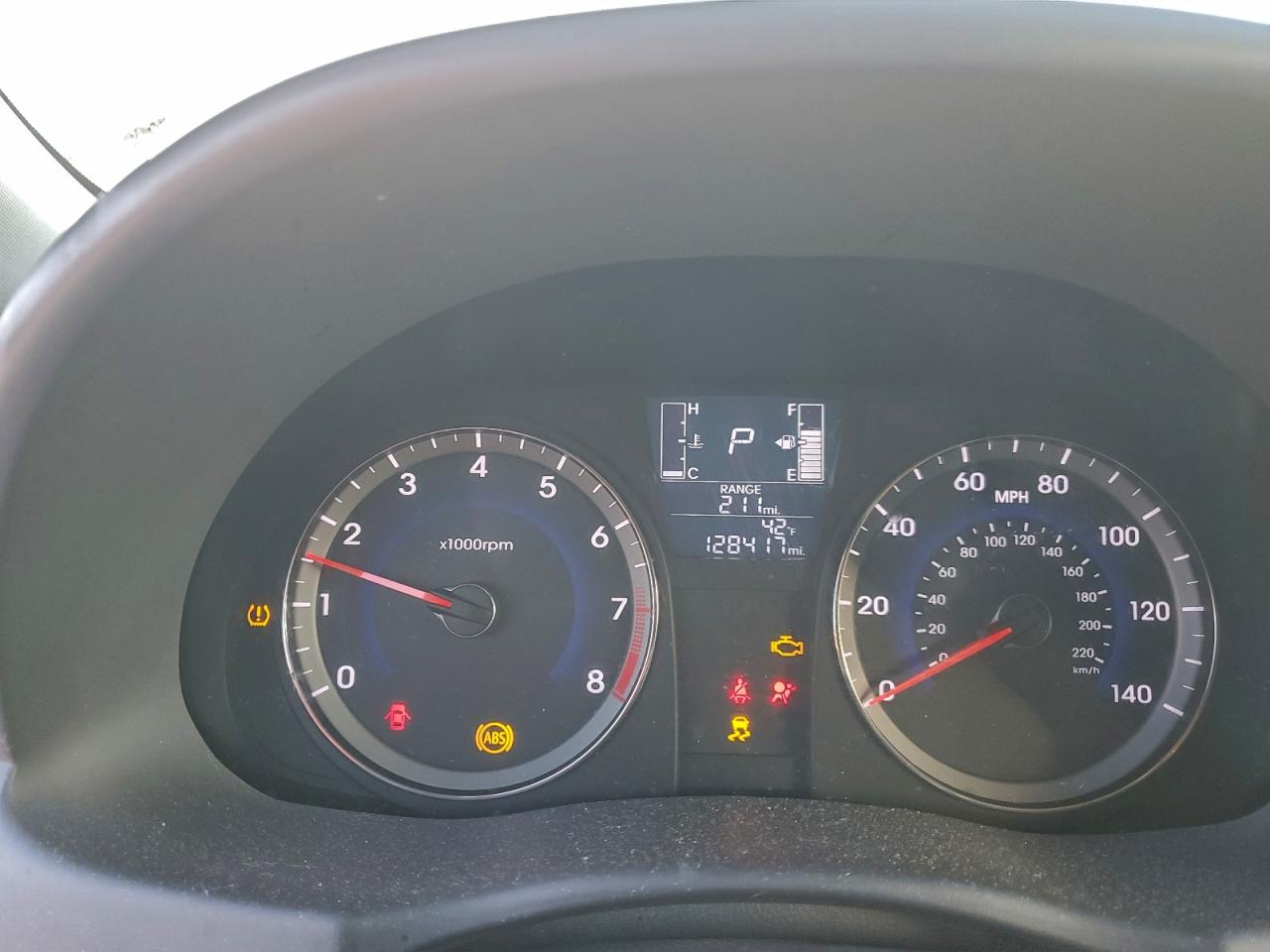2017 HYUNDAI ACCENT SE photo 9