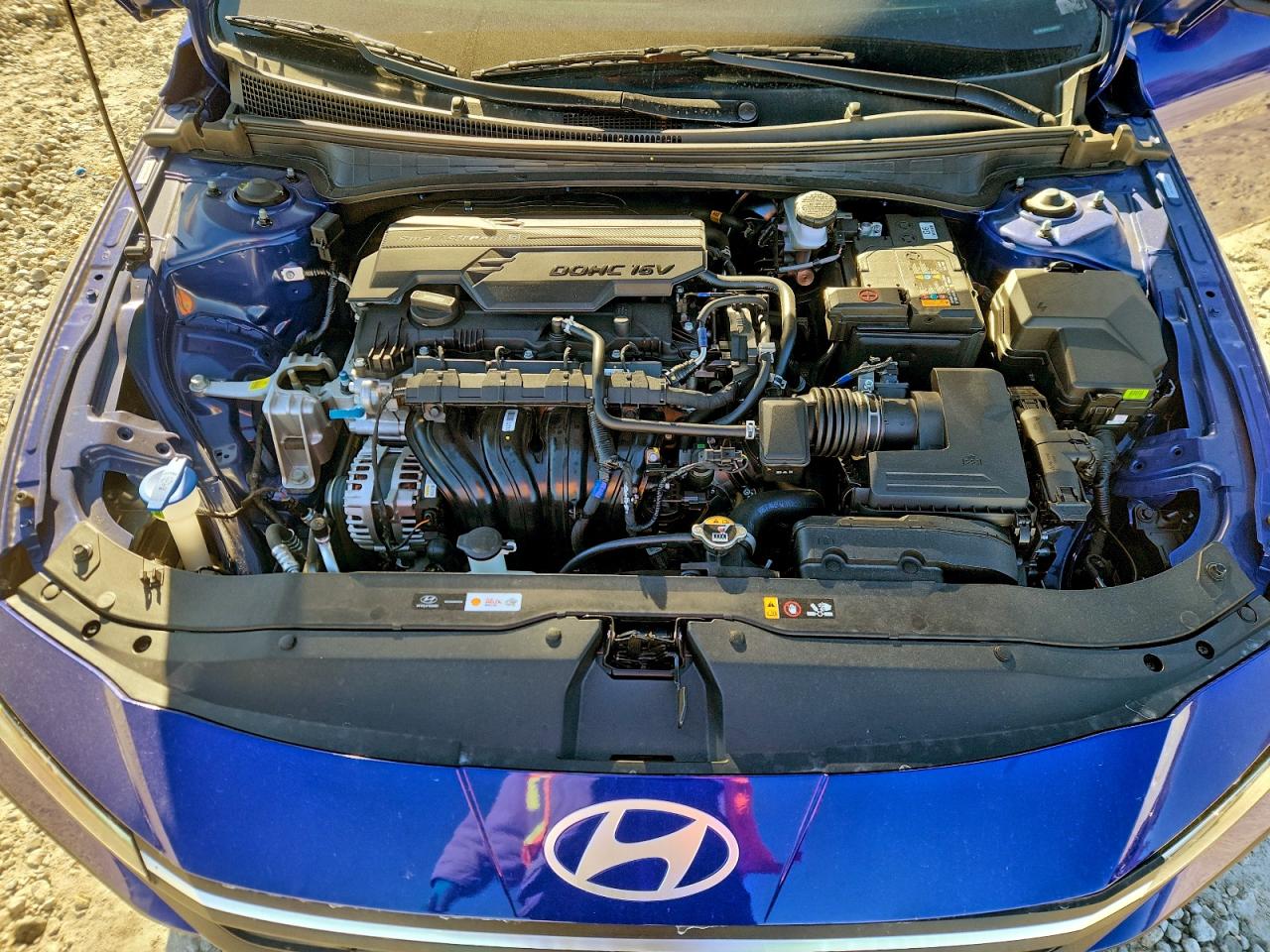 2025 HYUNDAI ELANTRA SEL SPORT photo 11