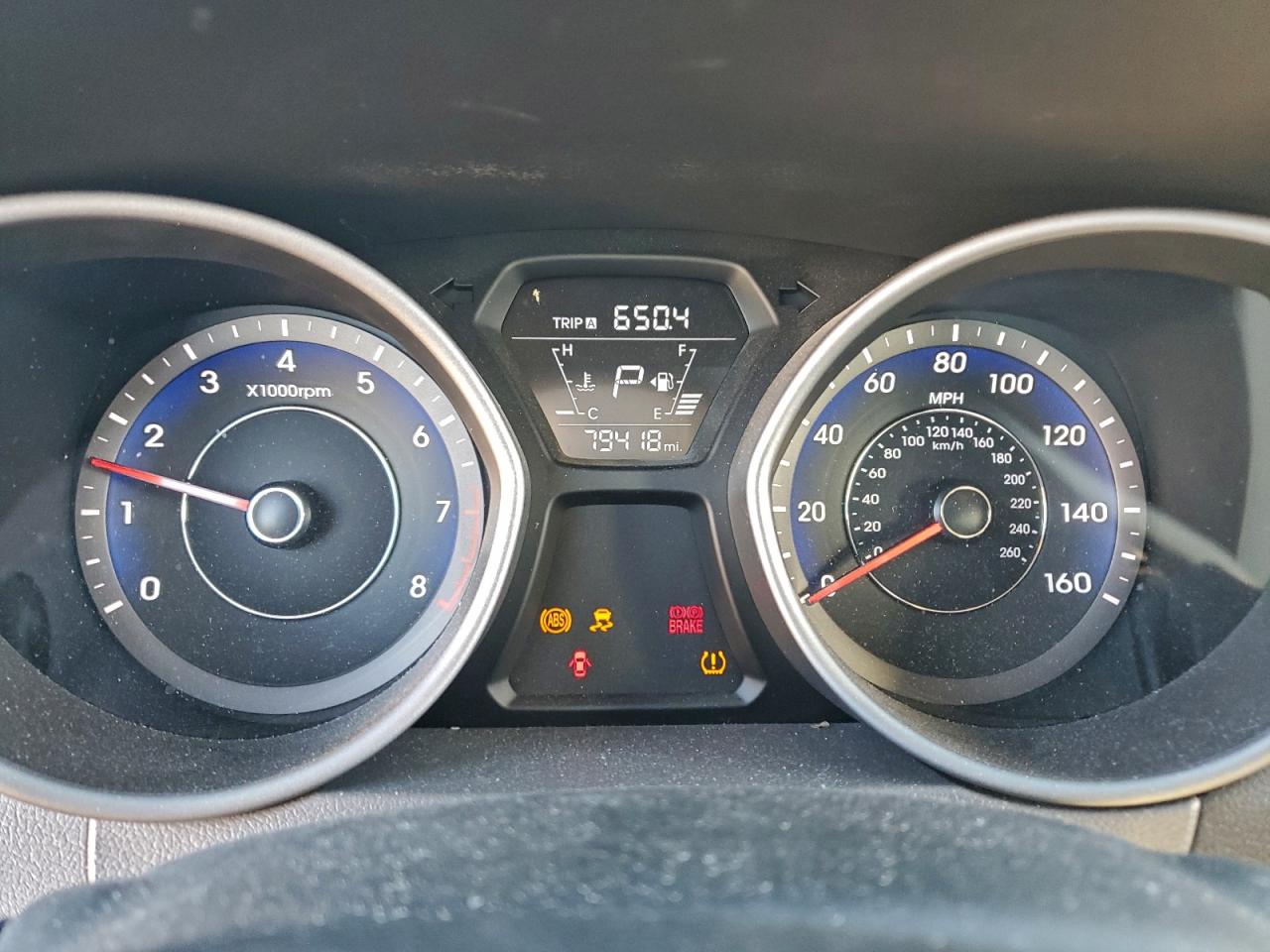2015 HYUNDAI ELANTRA SE photo 9