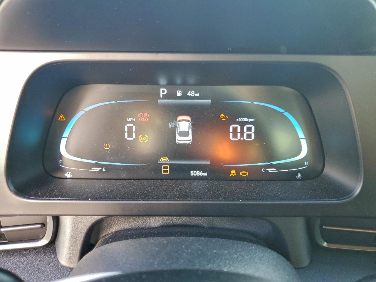 2025 HYUNDAI ELANTRA SEL SPORT photo 9