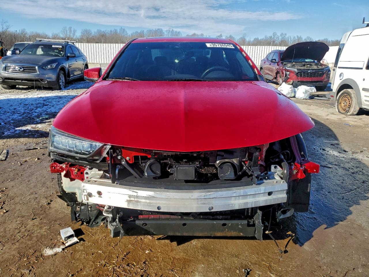 2018 ACURA TLX TECH+A photo 5