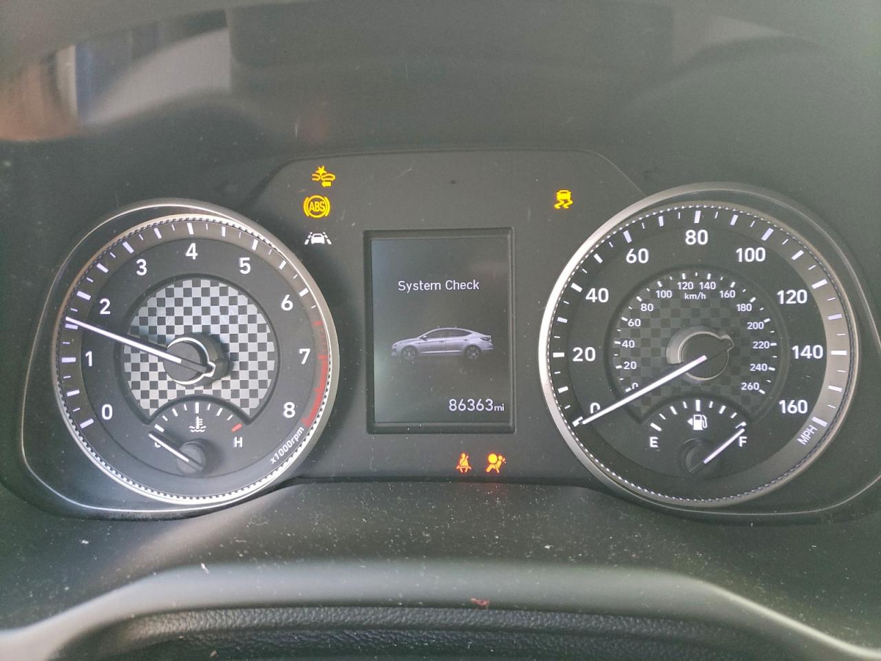 2020 HYUNDAI ELANTRA SEL photo 9