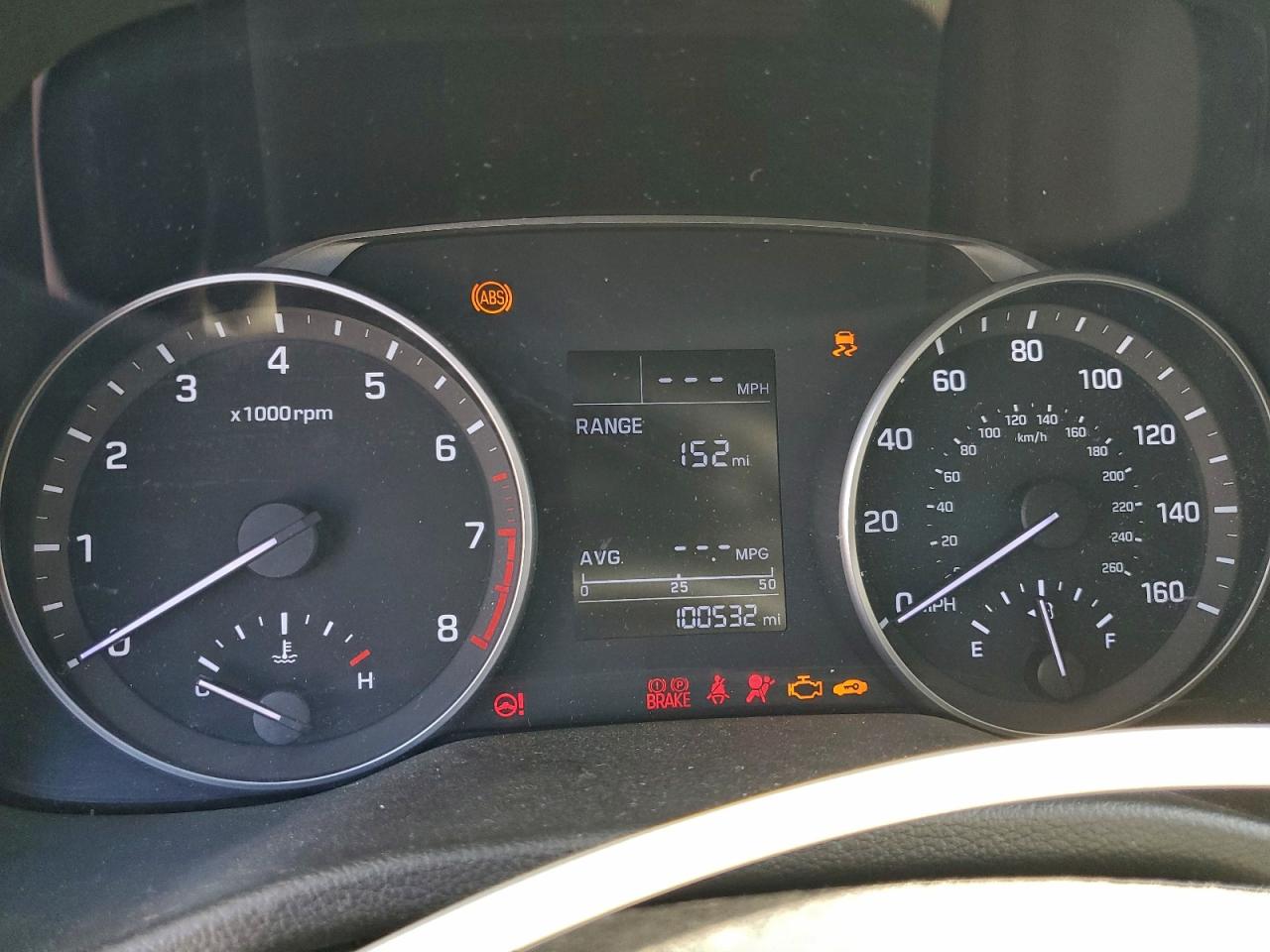 2017 HYUNDAI ELANTRA SE photo 17