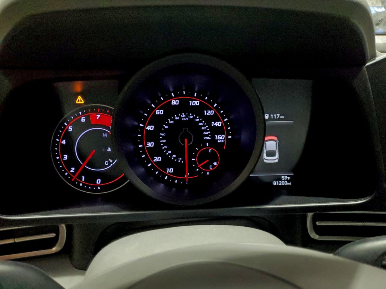 2023 HYUNDAI ELANTRA SEL photo 9