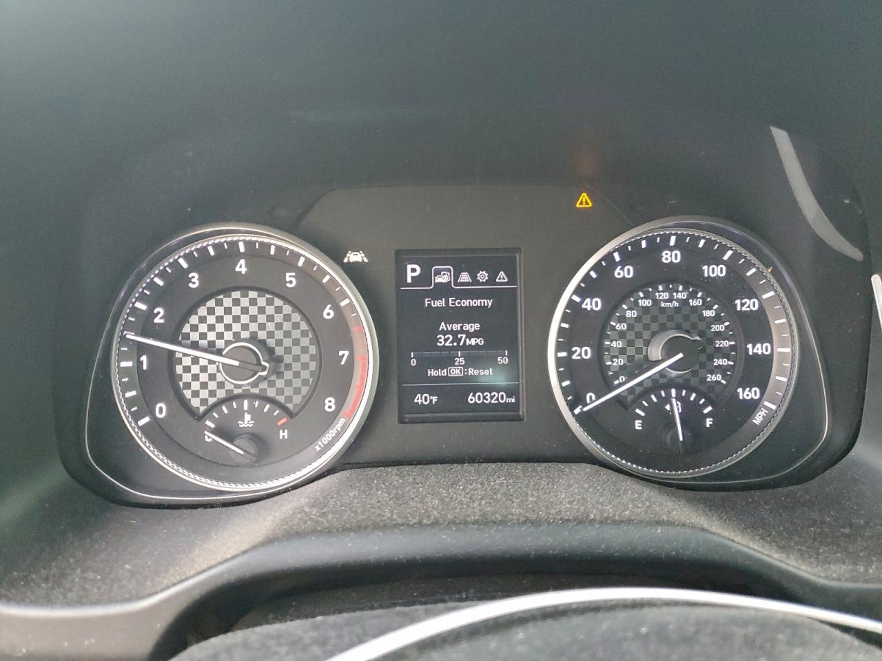 2020 HYUNDAI ELANTRA SEL photo 17