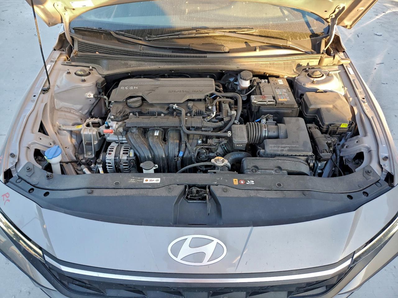 2024 HYUNDAI ELANTRA SEL photo 11