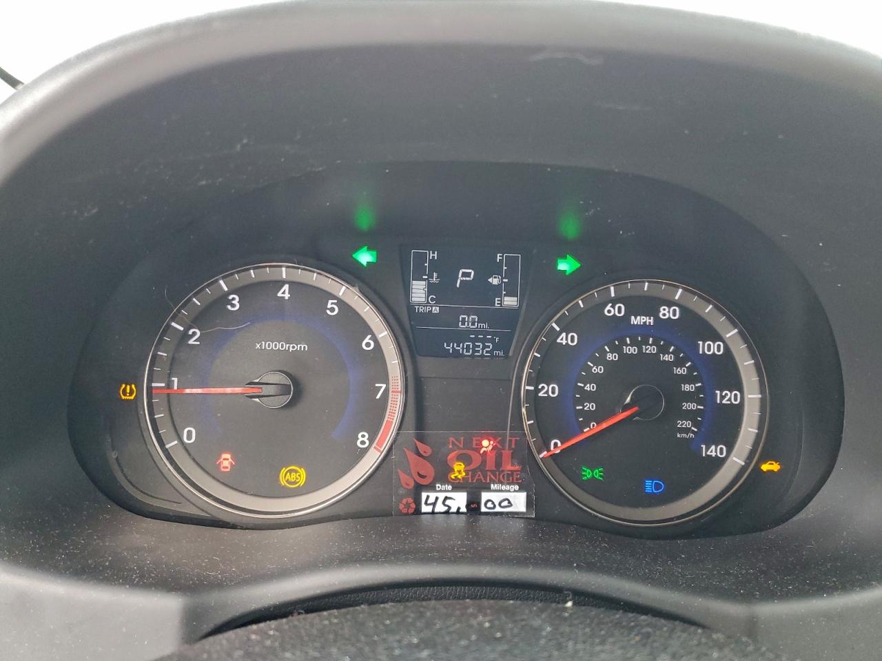 2016 HYUNDAI ACCENT SE photo 17