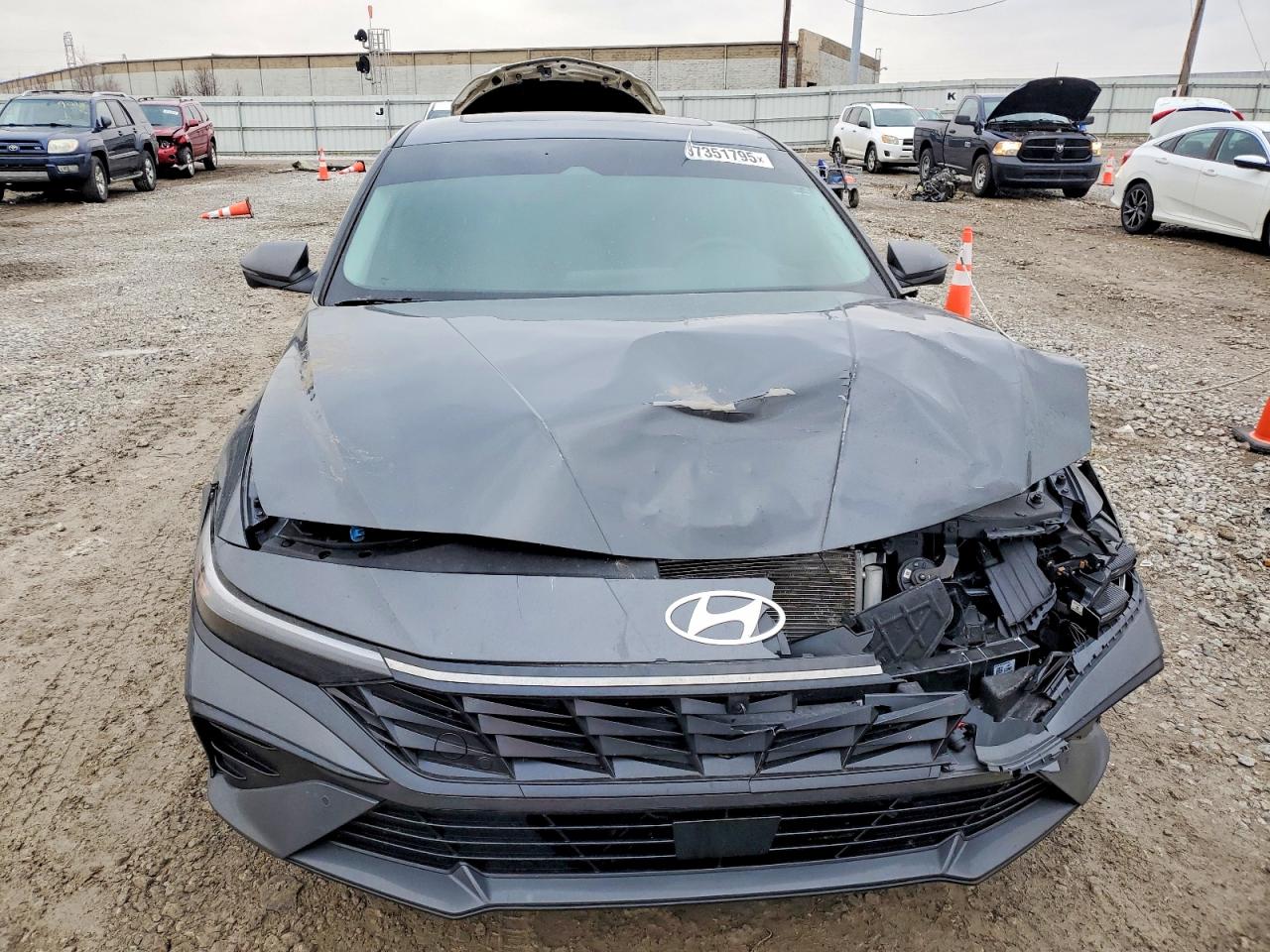 2024 HYUNDAI ELANTRA LIMITED photo 5
